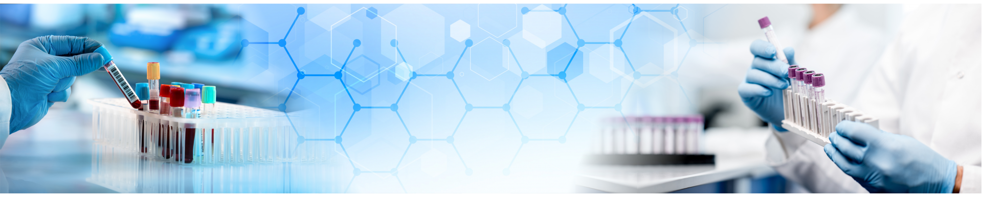 Преаналитика