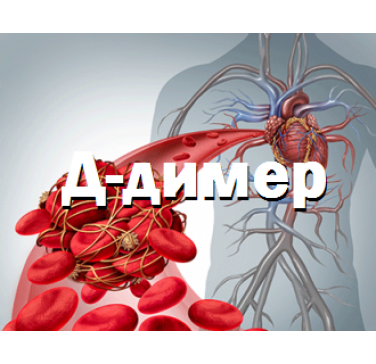 Д-димер – современный диагностический маркер